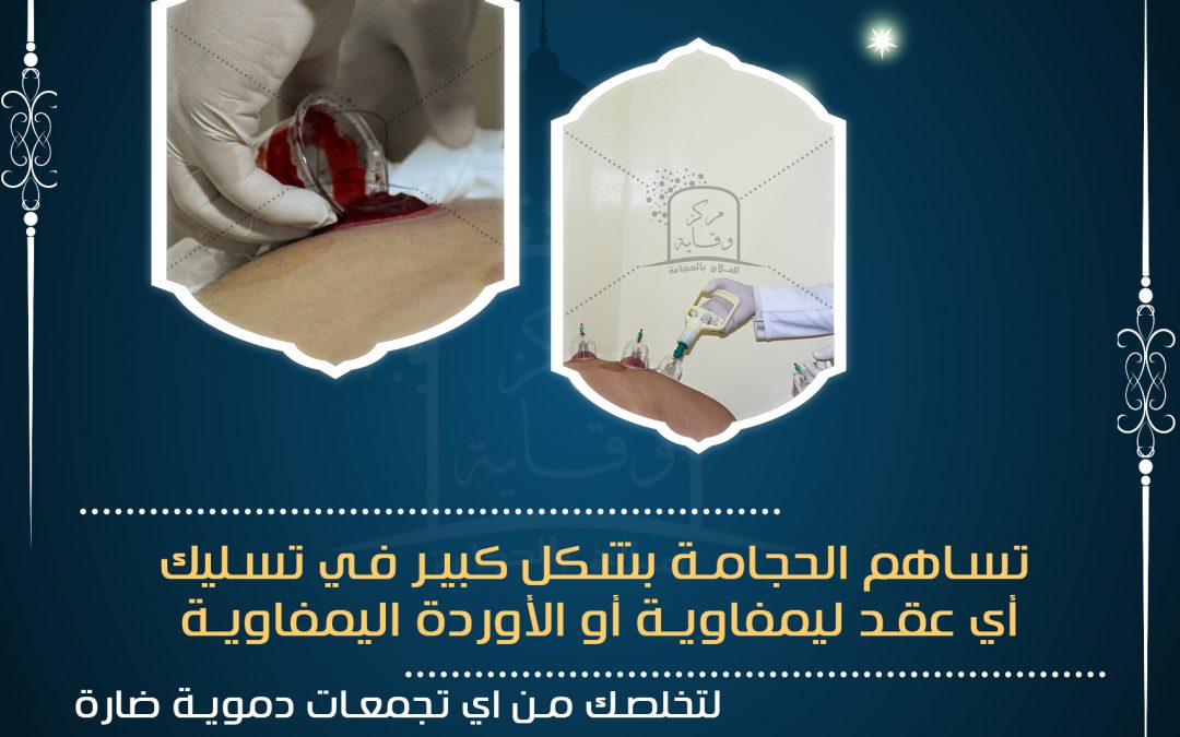 حجامة تسليك الاوعية اللمفاوية