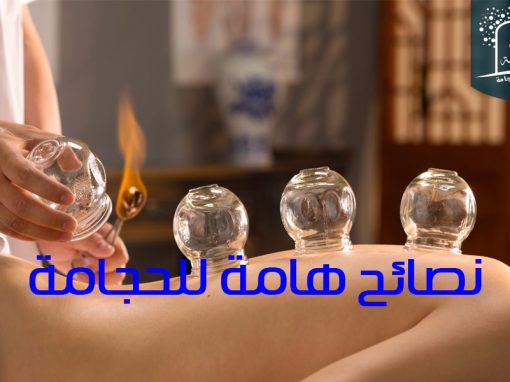 نصائح هامة للحجامة