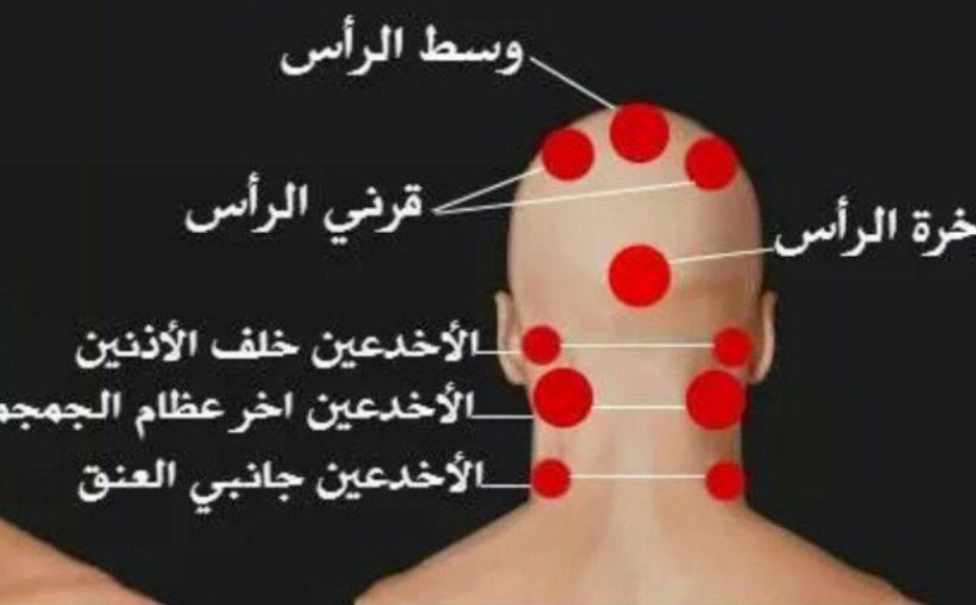 فوائد الحجامة في وسط الرأس