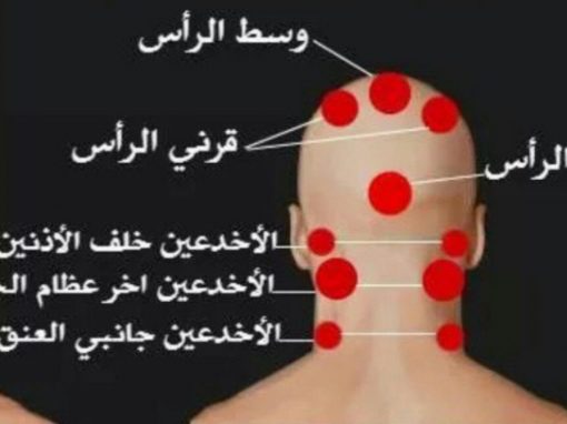 فوائد الحجامة في وسط الرأس