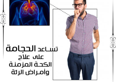 الحجامة لعلاج الكحة المزمنة وأمراض الرئة